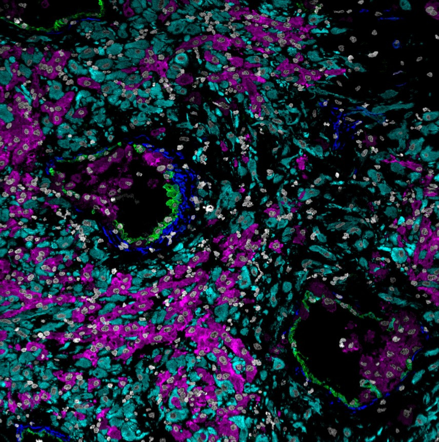 16_week_decidua_mibi_color_overlay_small_shirley_greenbaum_credit_stanford_university