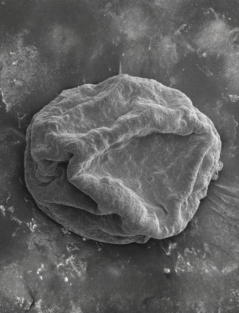 electron_microscopy_heart.