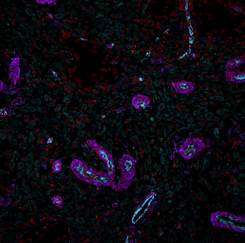 mibi_color_overlay_6_week_decidua_sample_small_shirley_greenbaum_credit_stanford_university