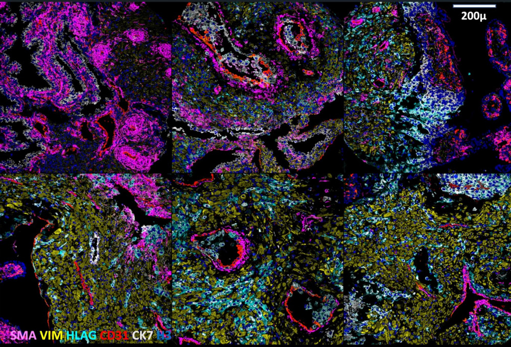 mibi_color_overlays_shirley_greenbaum_small_credit_stanford_university