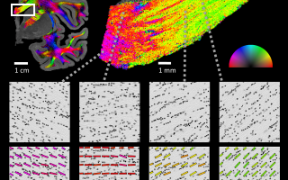 Novel Method Developed at Hebrew University Reveals Details of Nerve Connections in the Brain
