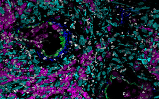 16_week_decidua_mibi_color_overlay_small_shirley_greenbaum_credit_stanford_university