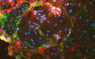 Credit: Moriyah Naama, Buganim Lab
