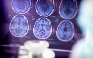 NewMRI
