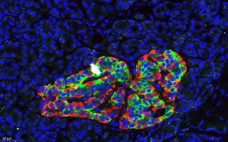 New DNA Methylation-Based Method