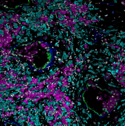 16_week_decidua_mibi_color_overlay_small_shirley_greenbaum_credit_stanford_university