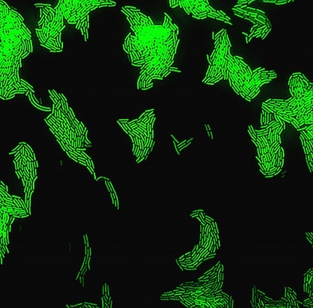 bacteria