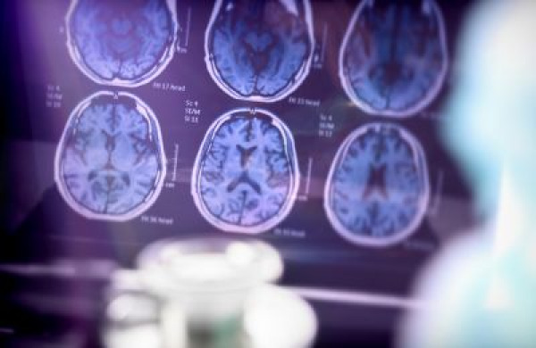 NewMRI