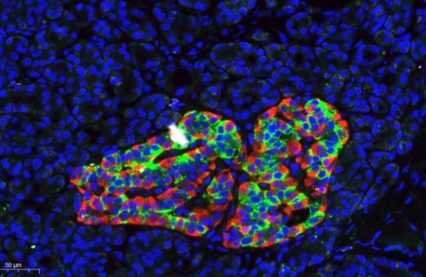 New DNA Methylation-Based Method