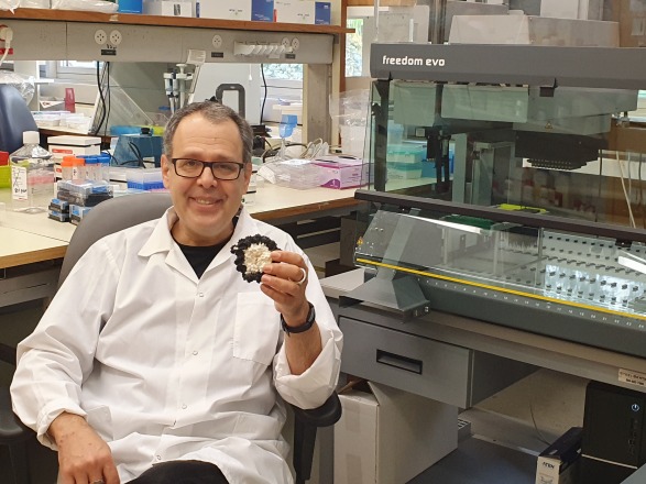 An End to Invasive Biopsies? Hebrew University Researchers Advance Simple and Inexpensive Diagnostic Blood Test